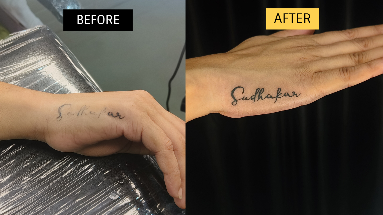Cover-Up Tattoo 1